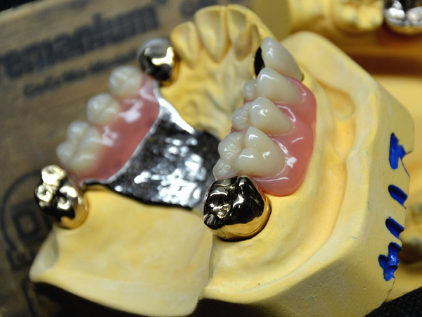 Dentallabor Kröger